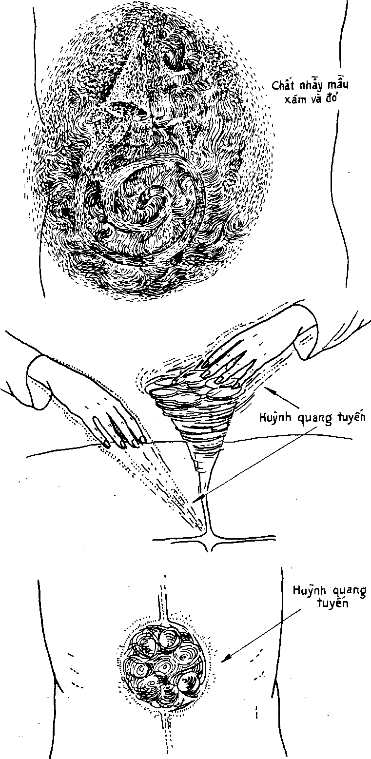 Hình trong sách